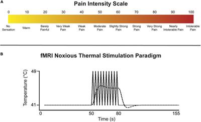 Evidence for Integration of Cognitive, Affective, and Autonomic Influences During the Experience of Acute Pain in Healthy Human Volunteers